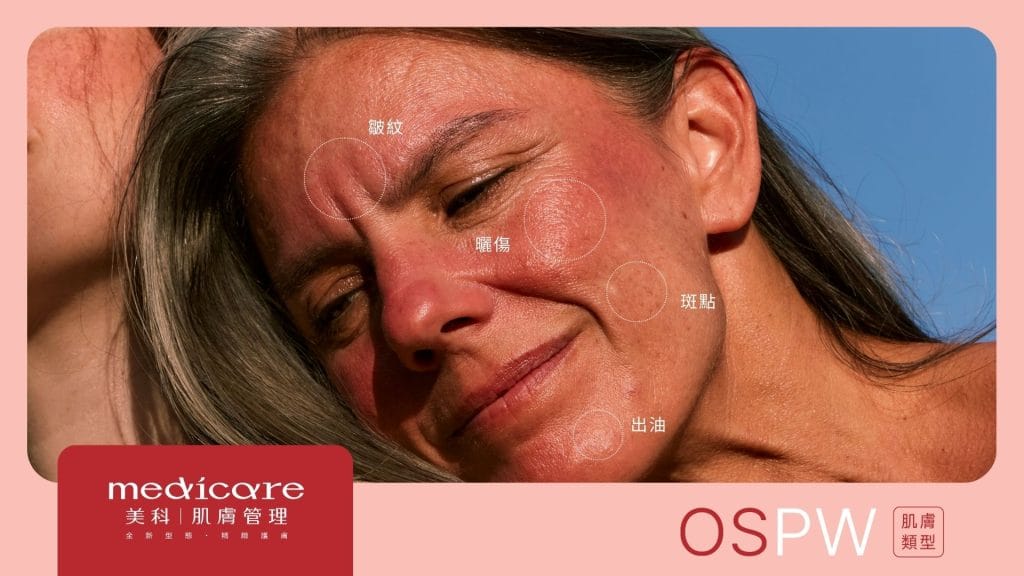 oil-sensitive-pigmented-wrinkled