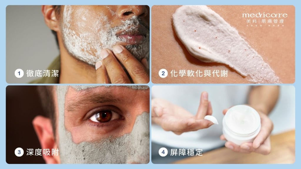 清粉刺正確流程