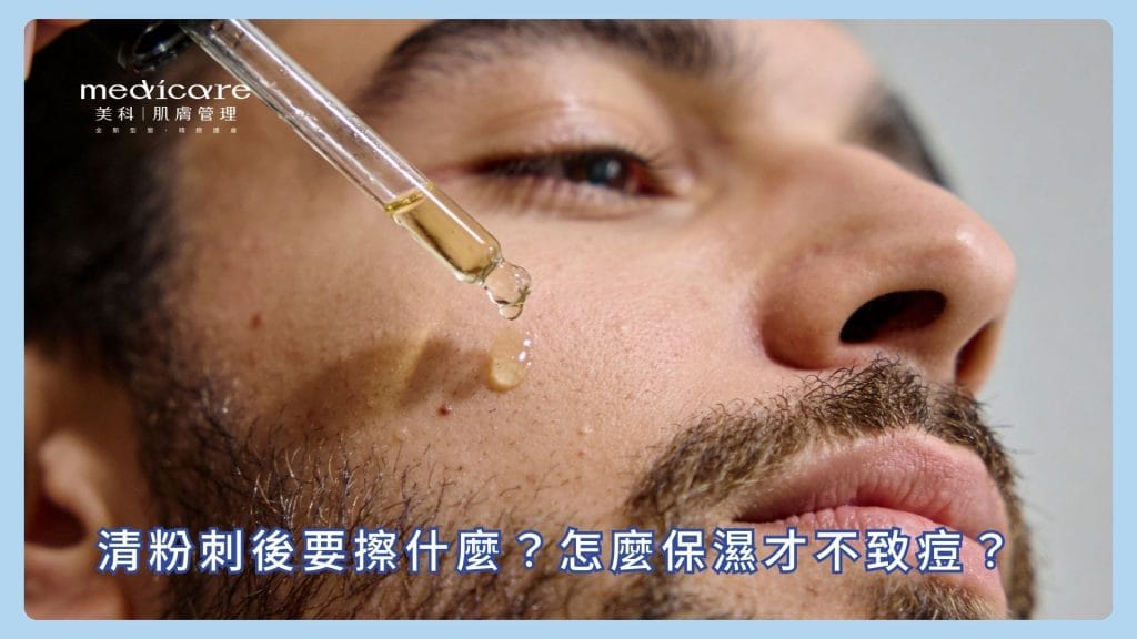 男生清粉刺後要擦什麼？