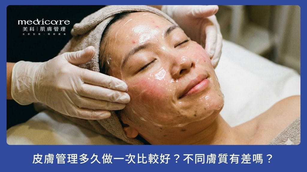 皮膚管理多久做一次比較好?不同膚質有差嗎?