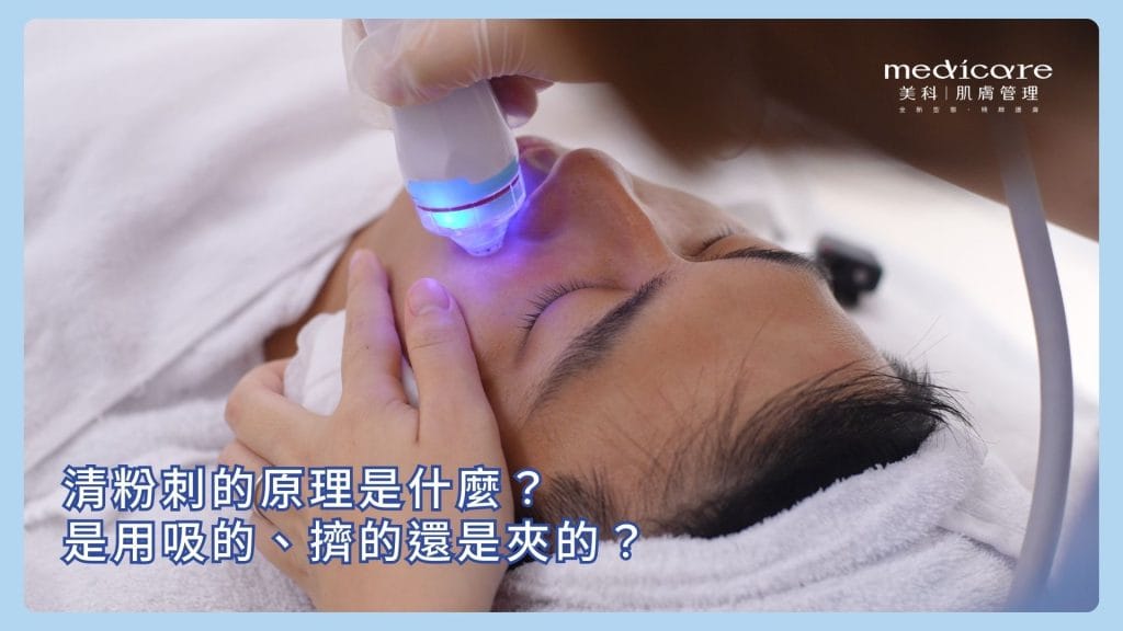 清粉刺的原理是什麼？