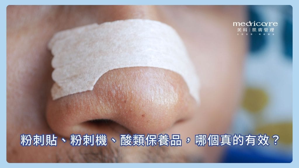妙鼻貼有效嗎？
